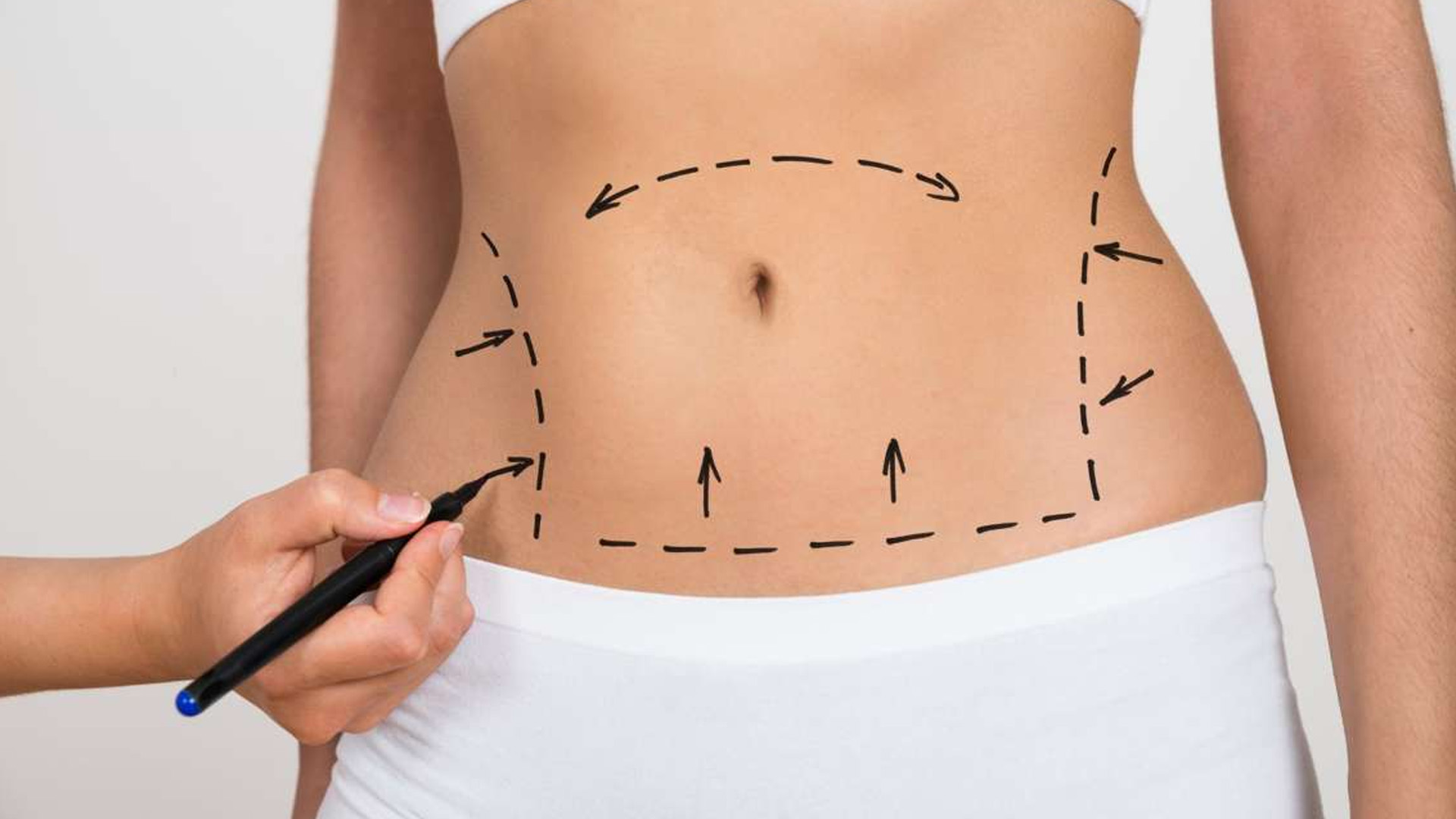 Abdominoplasty, an Important Cosmetic Surgery Right now