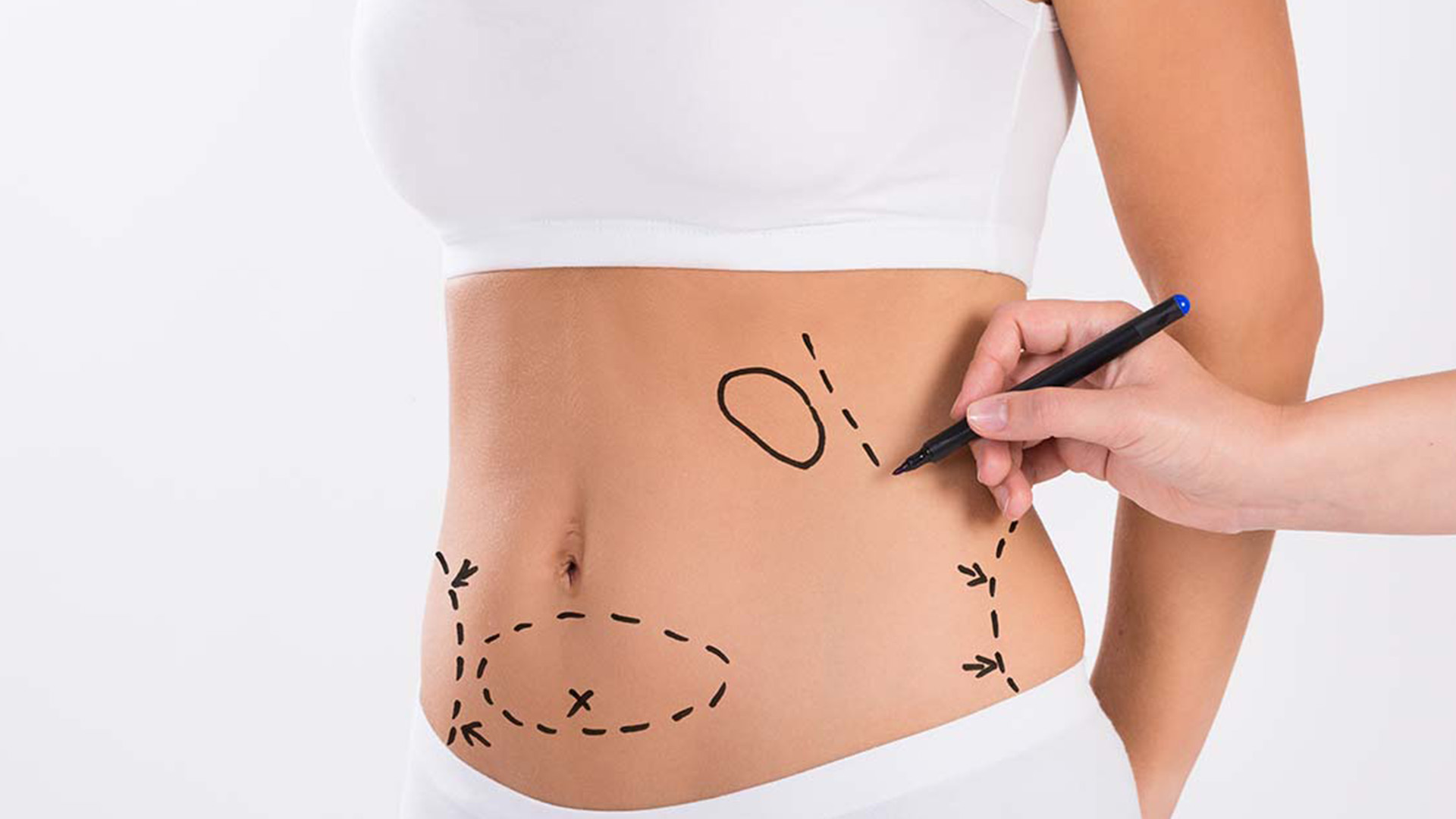 Medical benefits of Tummy Tuck Surgery