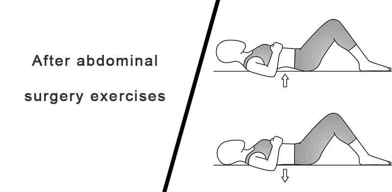 after abdominal surgery exercises