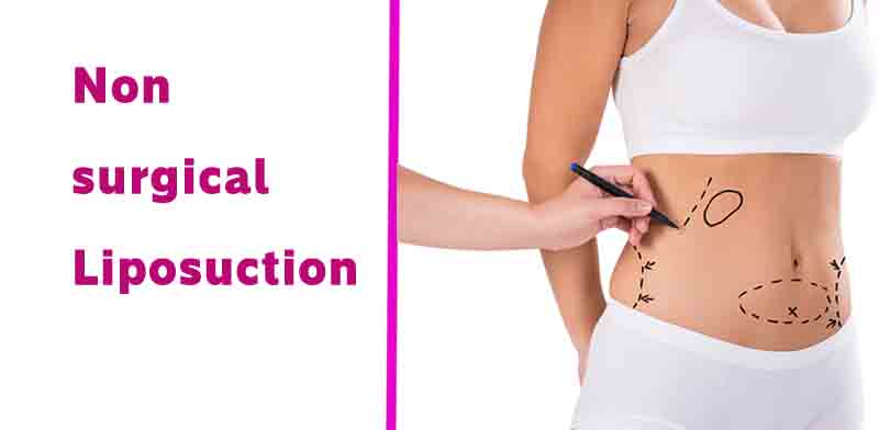 Non-surgical liposuction: How does it work?