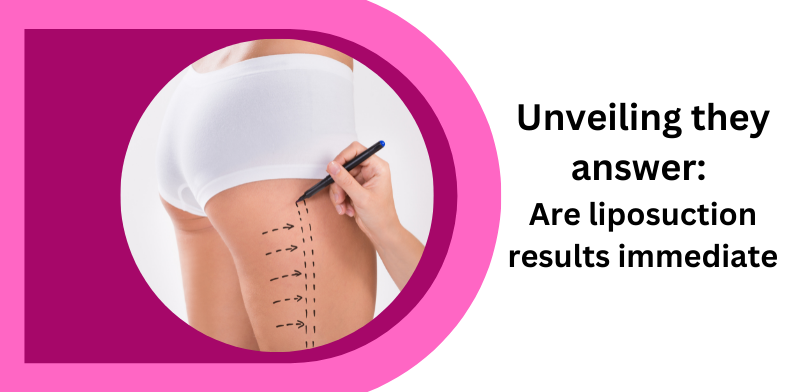 Unveiling they answer: Are liposuction results immediate?