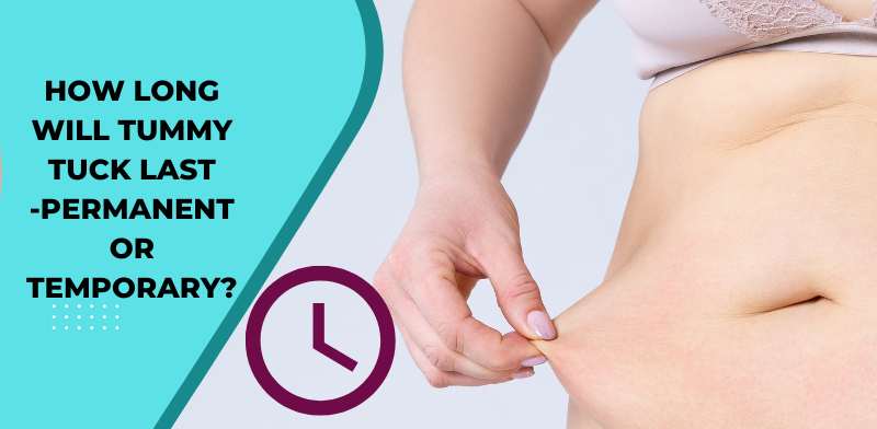 How long will tummy tuck last - permanent or temporary