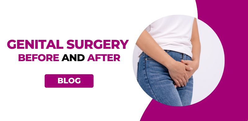 Genital Surgery Before and After