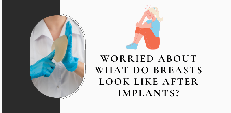 Worried about what do breasts look like after implants?