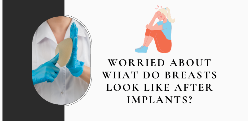 What do breasts look like after implants?