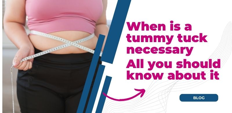 When is a tummy tuck necessary: All you should know about it