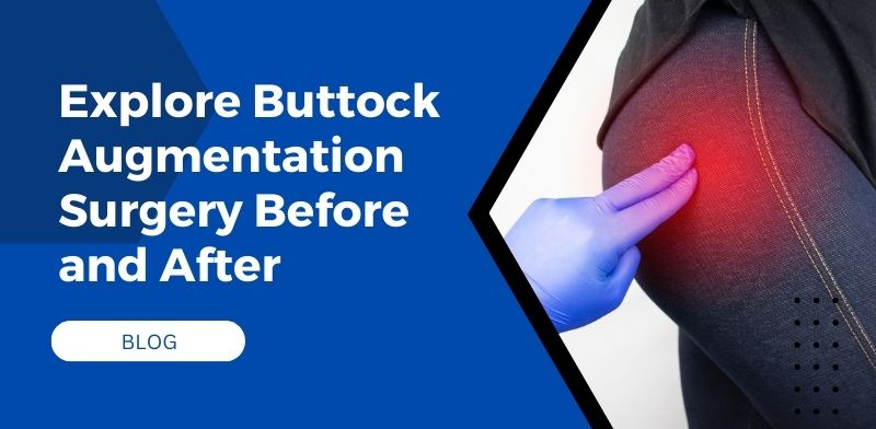 Explore Buttock Augmentation Surgery Before and After