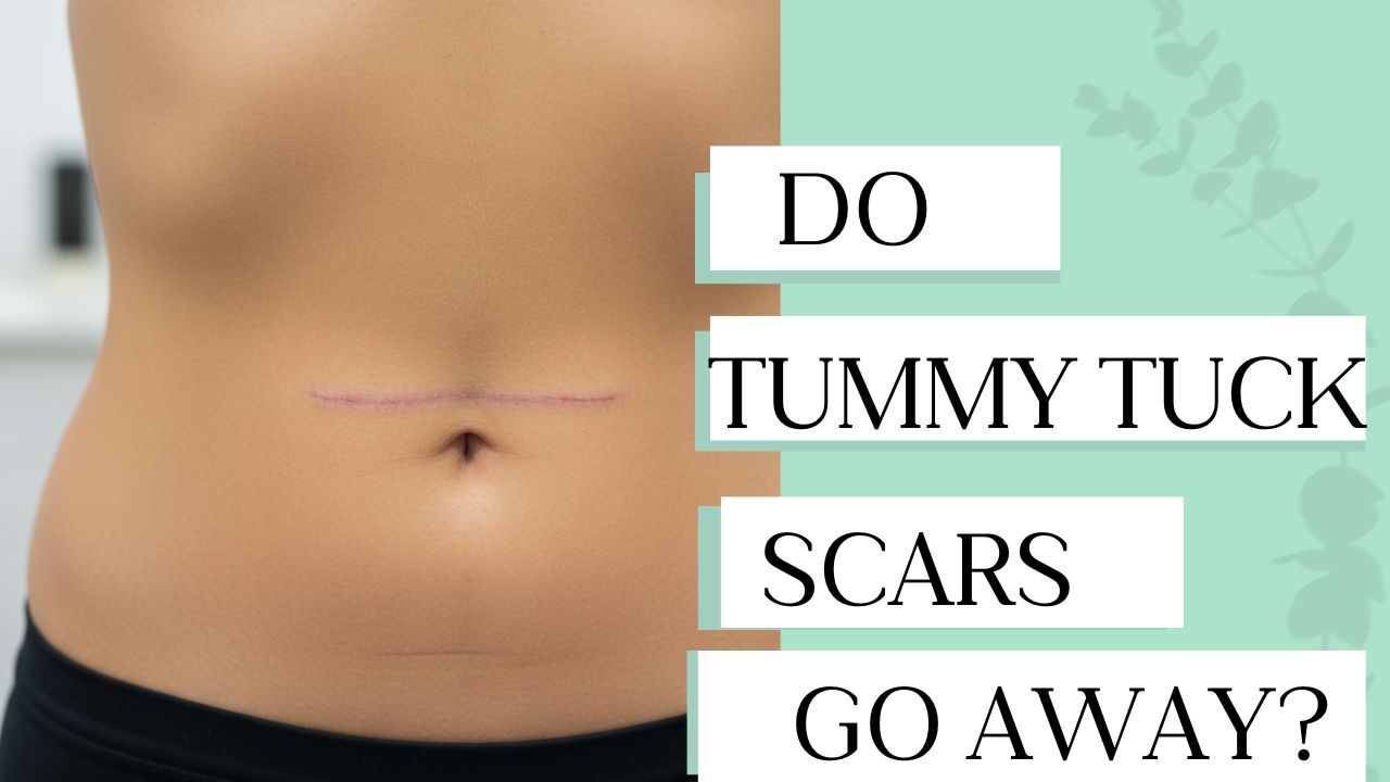 Do Tummy Tuck Scars Go Away?