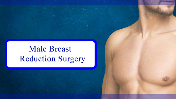 Male Breast Reduction Surgery - Cosmo Arts Clinic